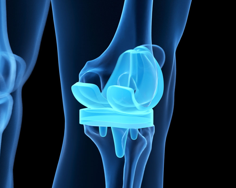 analisi chimica dispositivi biomedicali